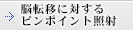 脳転移に対するピンポイント照射