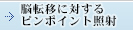 脳転移に対するピンポイント照射