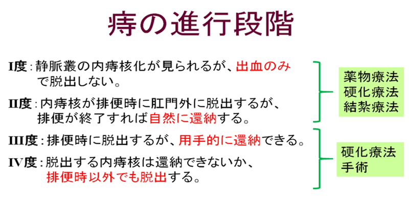 痔の進行