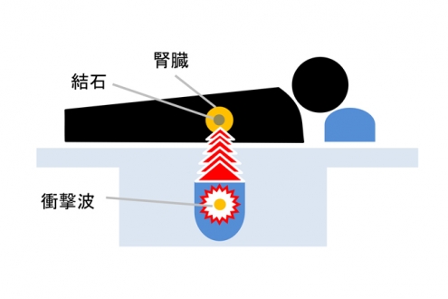 破砕イメージ図